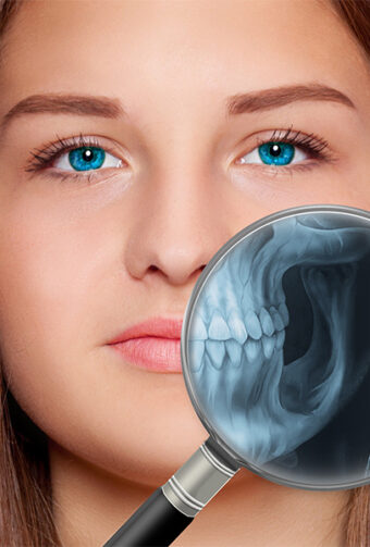 Importance of Digital X-Rays
