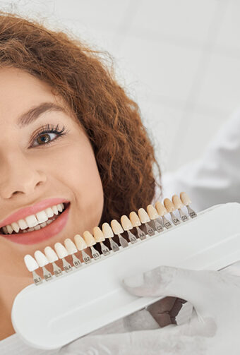 What Are Composite Veneers, And How Long Do They Last?