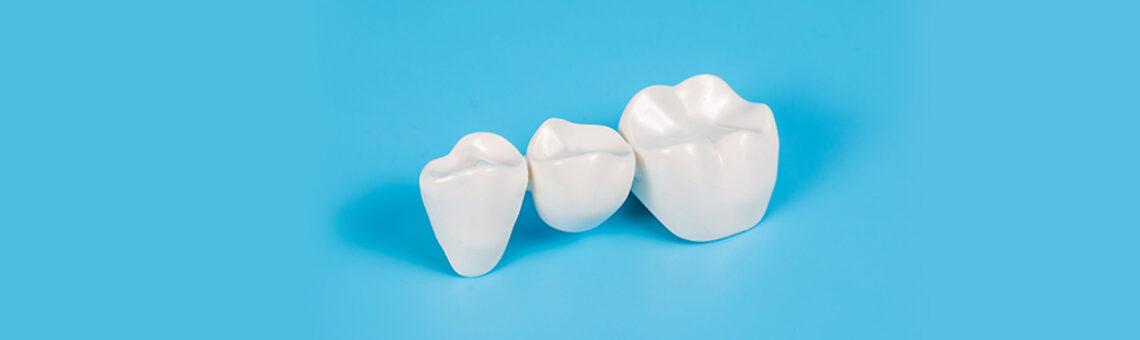 What Are Dental Crowns Made Of? A Guide to Your Choices