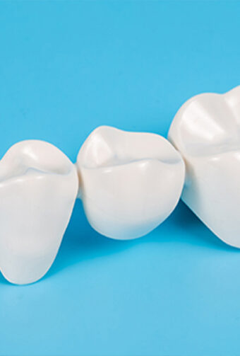 What Are Dental Crowns Made Of? A Guide to Your Choices