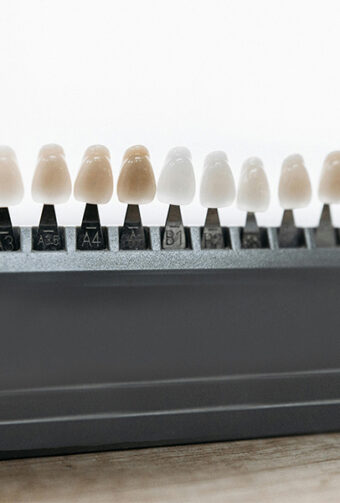 Affordable Dental Veneers in Pleasant Hill, CA: How to Get the Smile You Deserve